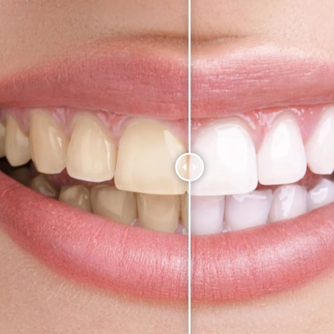 Before & After Images Comparison WordPress Plugin